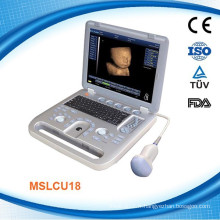 MSLCU18K CE ISO13485 approuvé 4D Digital Ultrasound Machine / scanner Doppler couleur avec DICOM 3.0